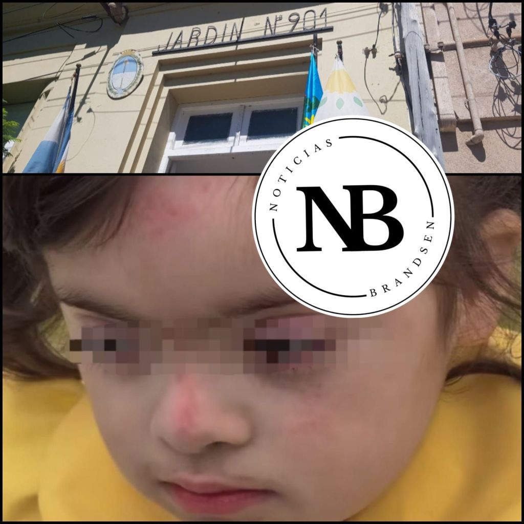 LLEVÓ A SU HIJA AL JARDÍN Y AL RETIRARLA, LA NENA TENIA LA CARA LASTIMADA «ME DIJERON QUE NO SABEN QUE LE&nbsp;PASÓ»