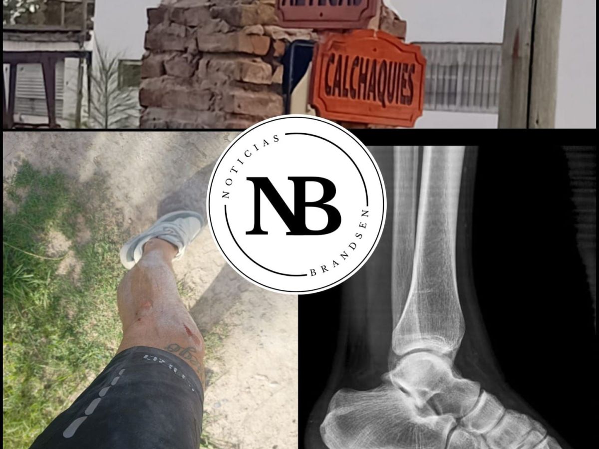 CAYÓ DE SU MOTO CUANDO VARIOS PERROS SALIERON A CORRERLO Y NINGÚN VECINO SALIÓ A ASISTIRLO «HAY MUY POCA&nbsp;EMPATÍA»